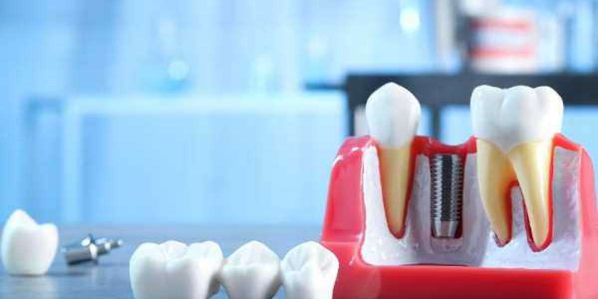 Quick-response dental services you can rely on in emergencies