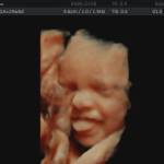 4d scan at 30 weeks