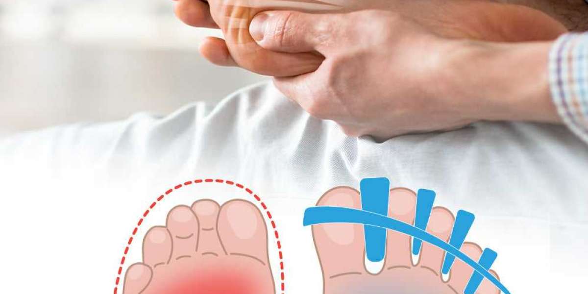 Toe Straighteners to Reduce Discomfort & Improve Posture