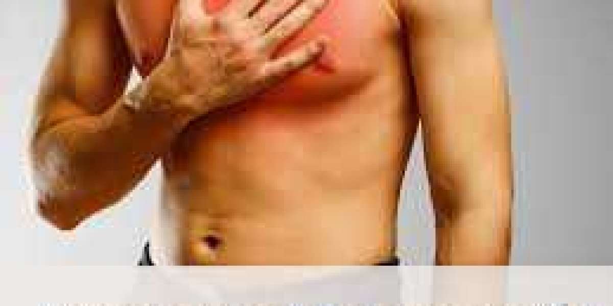 Gynecomastia Signs and Symptoms and Effective Ways on How to Reduce Arm Fat for Ladies