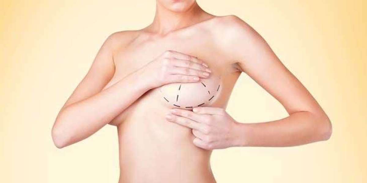 Transform Your Confidence with Breast Augmentation and Tummy Tuck in Dubai – By Dr. Hans Plastic Surgeon
