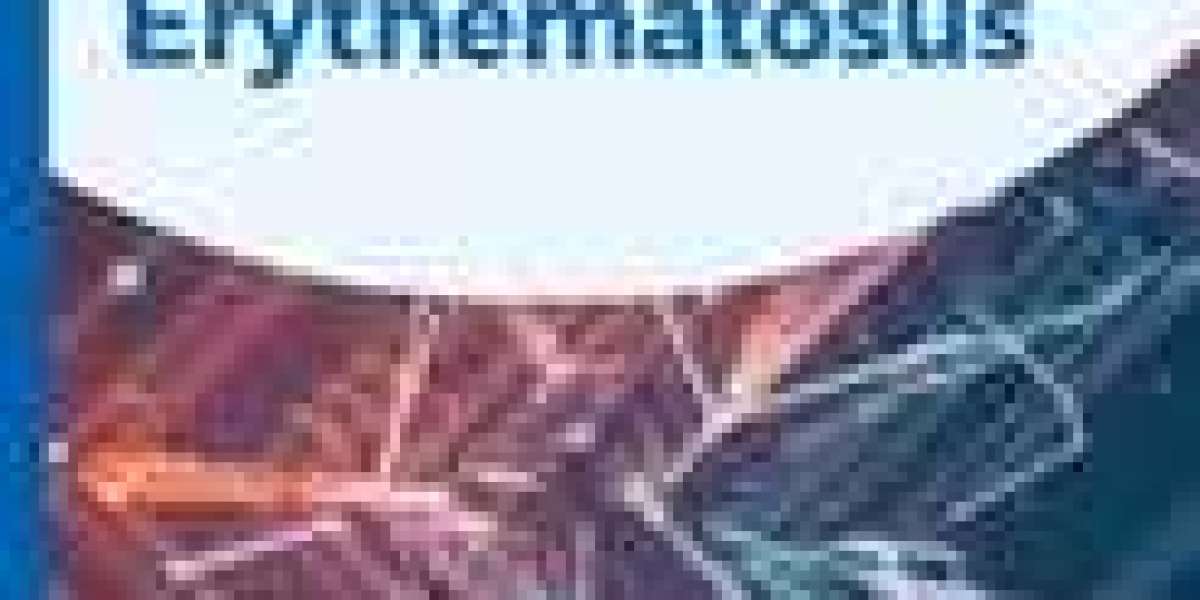 Systemic Lupus Erythematosus Market Growth Prospects — DelveInsight Study
