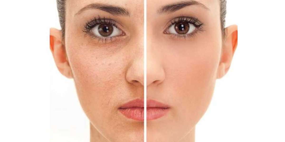 Nanobrows Mount Juliet – Precision Eyebrow Micropigmentation