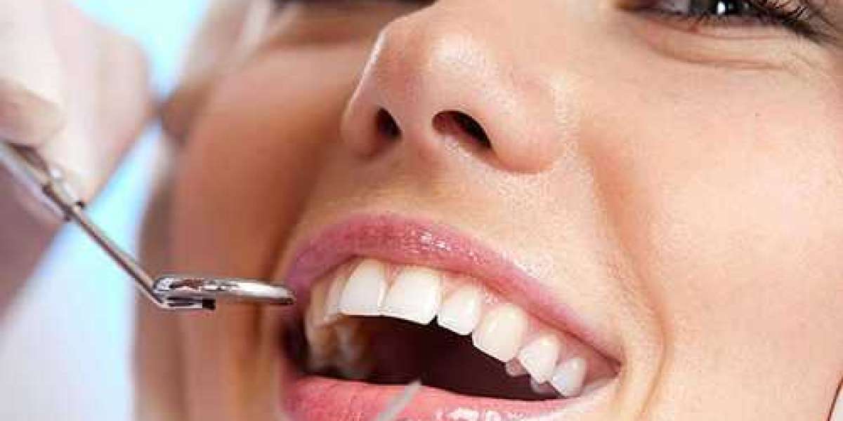 Achieve a Radiant Smile with Dental Implants in Tampa