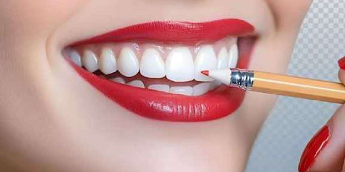 Sharanya Dental: Your Trusted Destination for Advanced Dental Care in Hyderabad