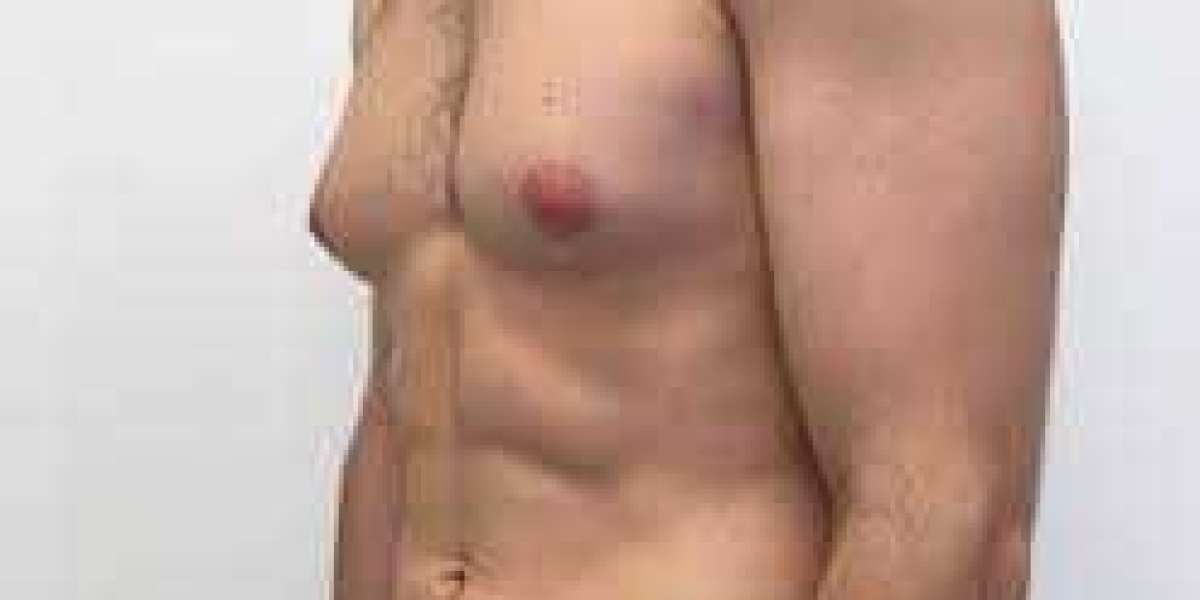 Enhance Your Feminine Confidence with Breast Augmentation in Islamabad