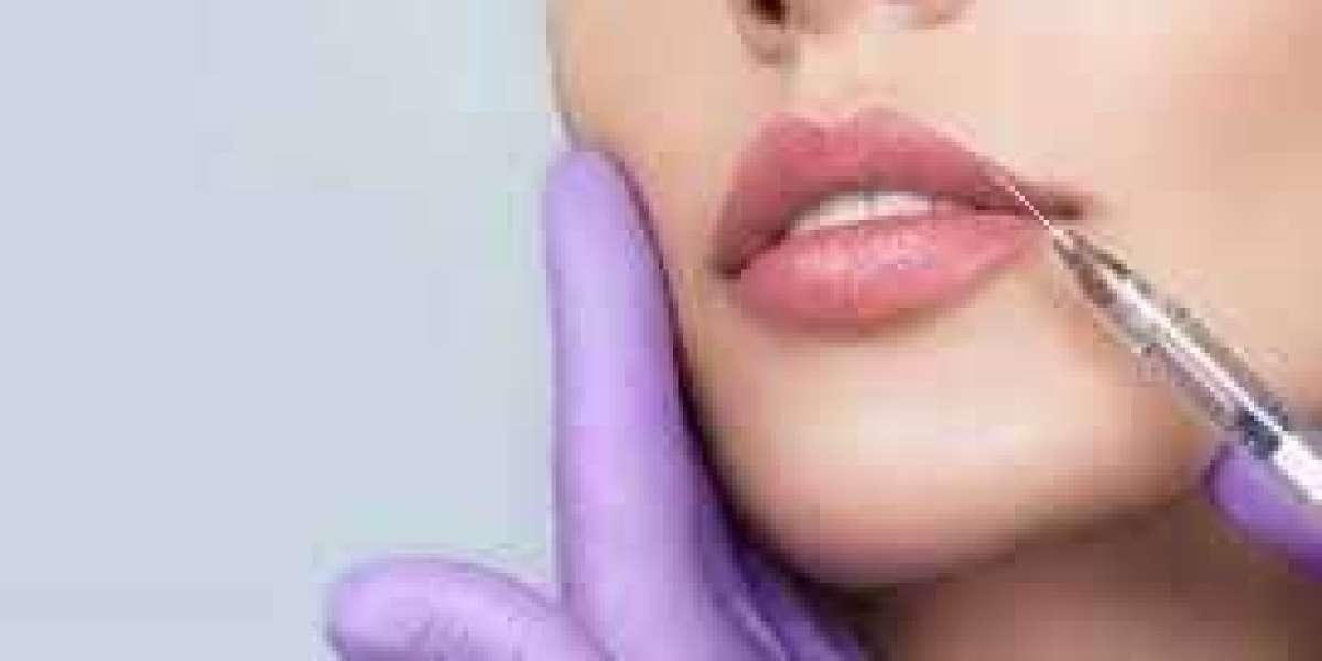 Dermal Fillers for Lips