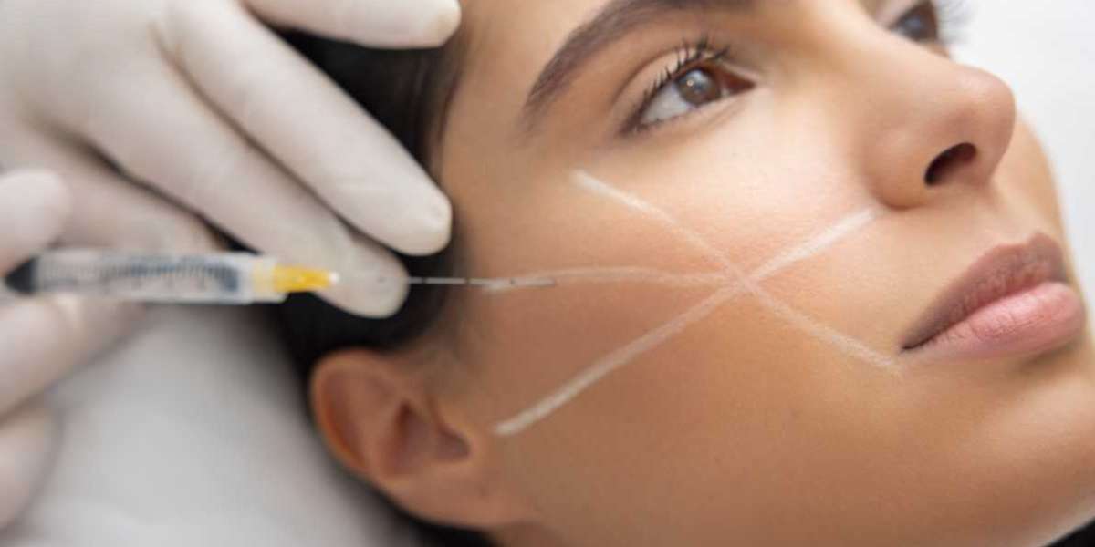 Sculptra Fillers in Dubai: The Secret to Natural Facial Rejuvenation